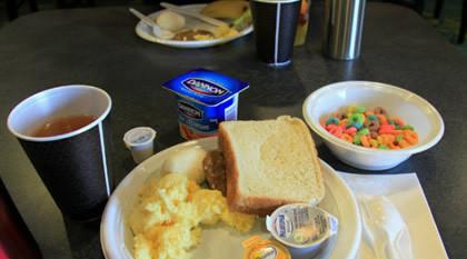 BJL平台集团:你会让扎眼的发际线抢走风采吗(图1) BJL平台